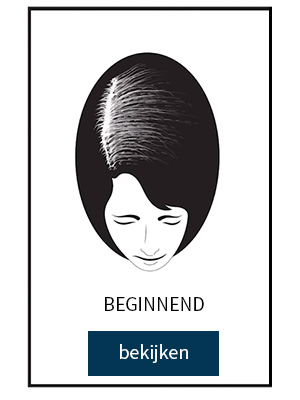 beginnend haaruitval beginnend haaruitval